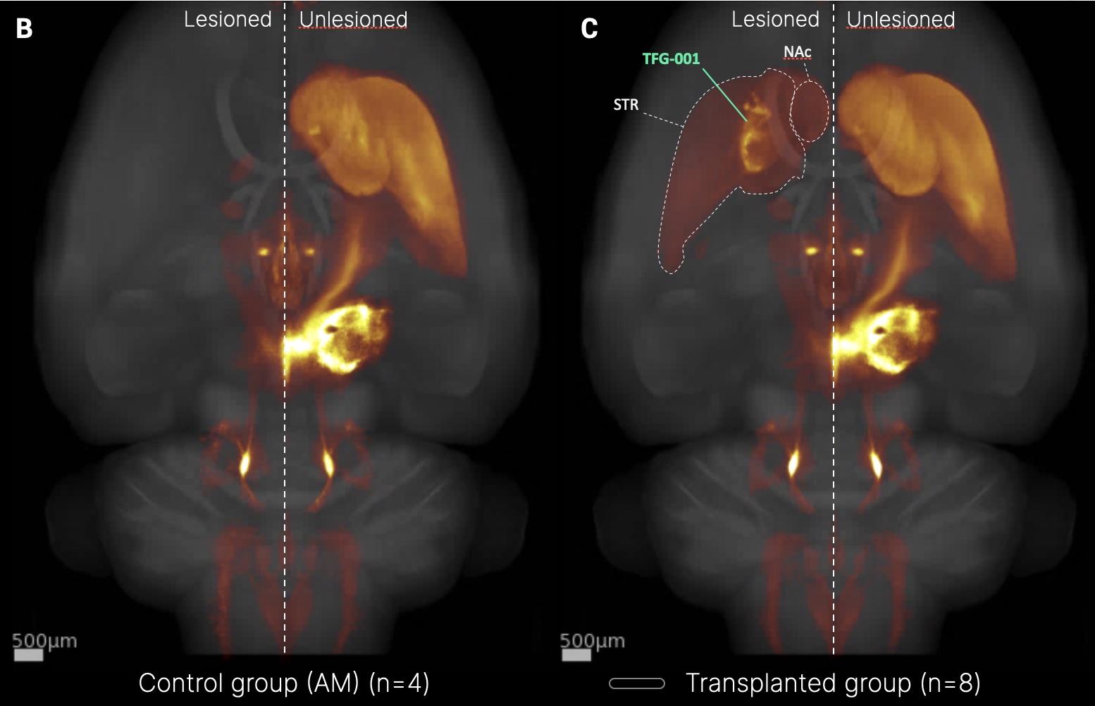 Rat brain — reinnervation with markings